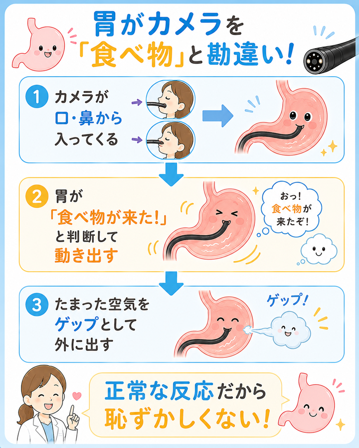胃がカメラを「食べ物」と勘違い!
