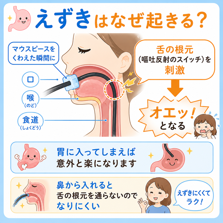 えずきはなぜ起きる？