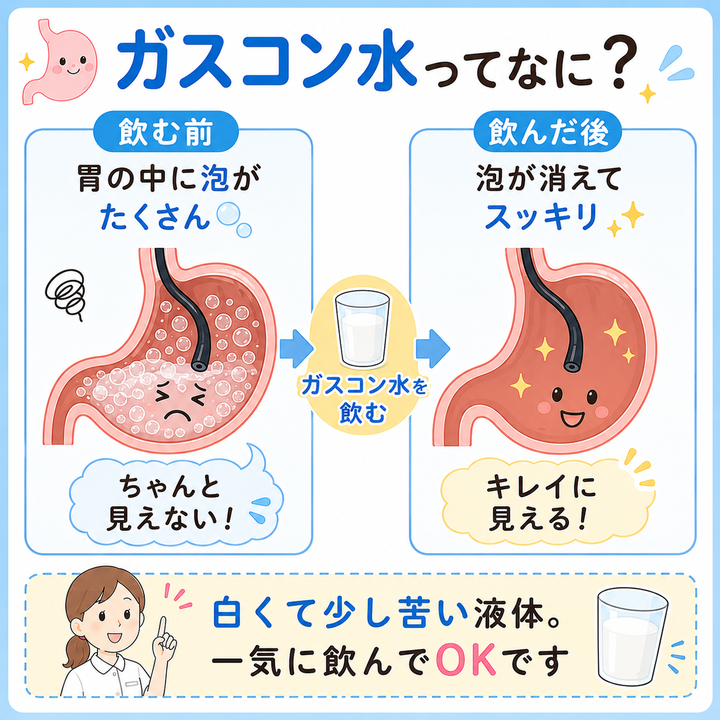 ガスコン水ってなに?